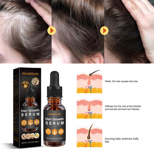 30ml Hair Growth Essence for Strong, Thick Hair Care